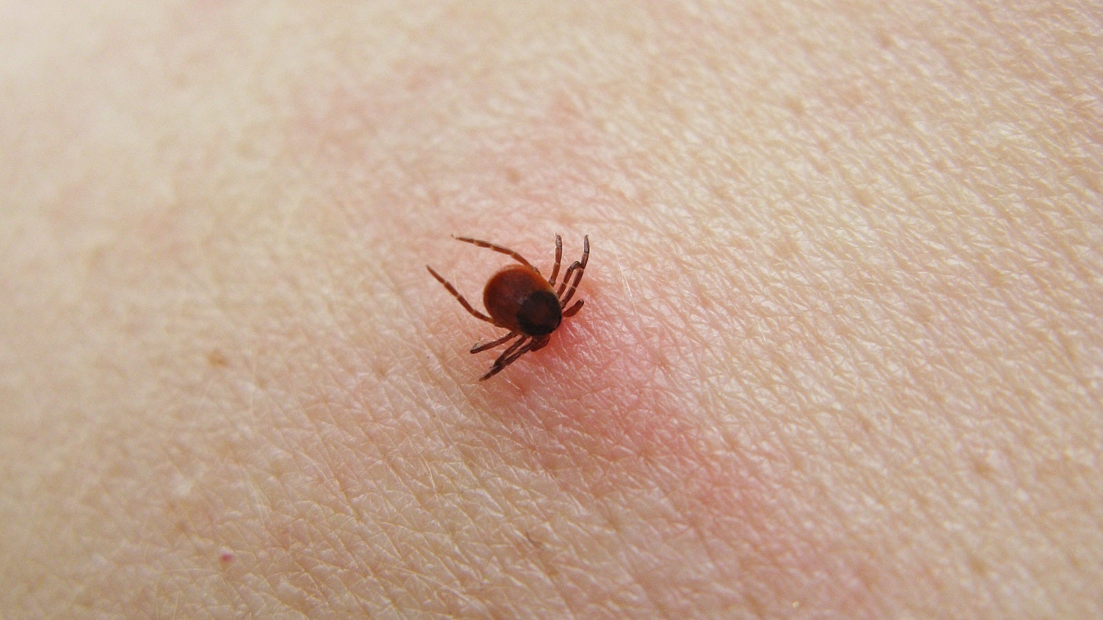 Vorsicht Ein Biss Dieser Zecke Reicht Aus Und Ihr Leidet An Einer Allergie Artikel Von The Weather Channel Weather Com