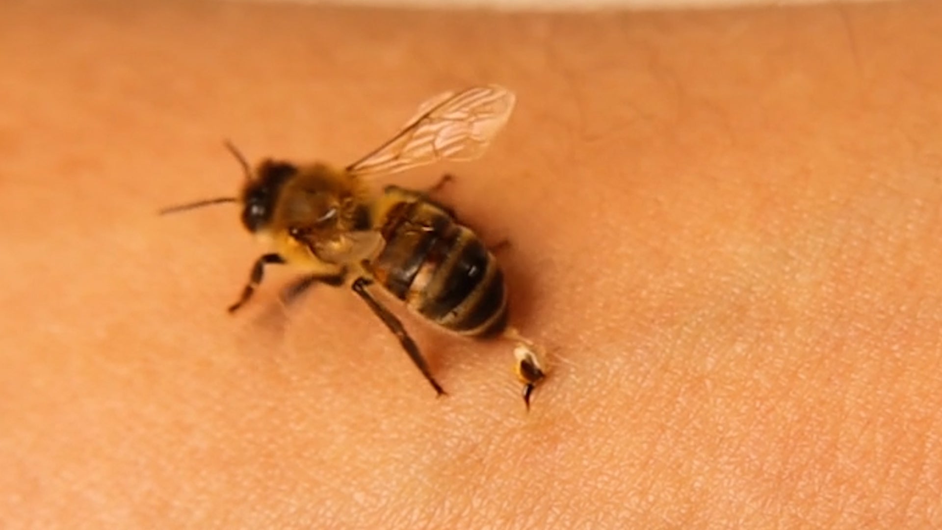 When A Bee Stings, Here&rsquo;s What To Do