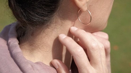 Melasma 101 From A Skin Health Expert