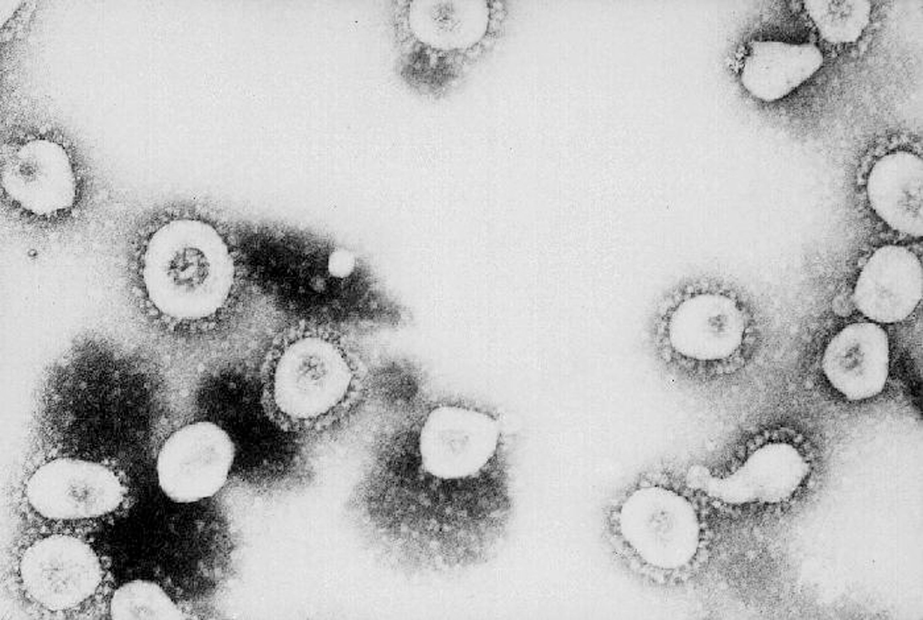 Deadly New Virus Alarms Researchers