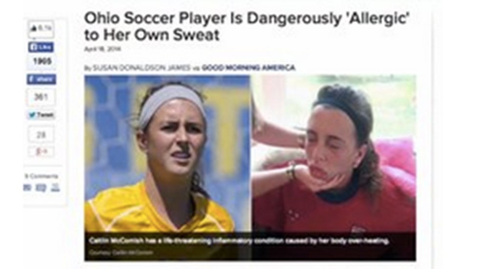 Dangerously Allergic to Her Own Sweat The Weather Channel