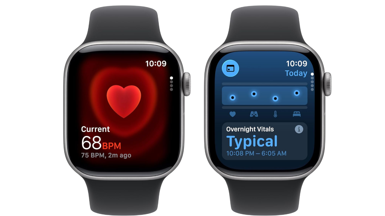 Apple Watch Series 11 GPS + Cellular 42mm Smartwatch