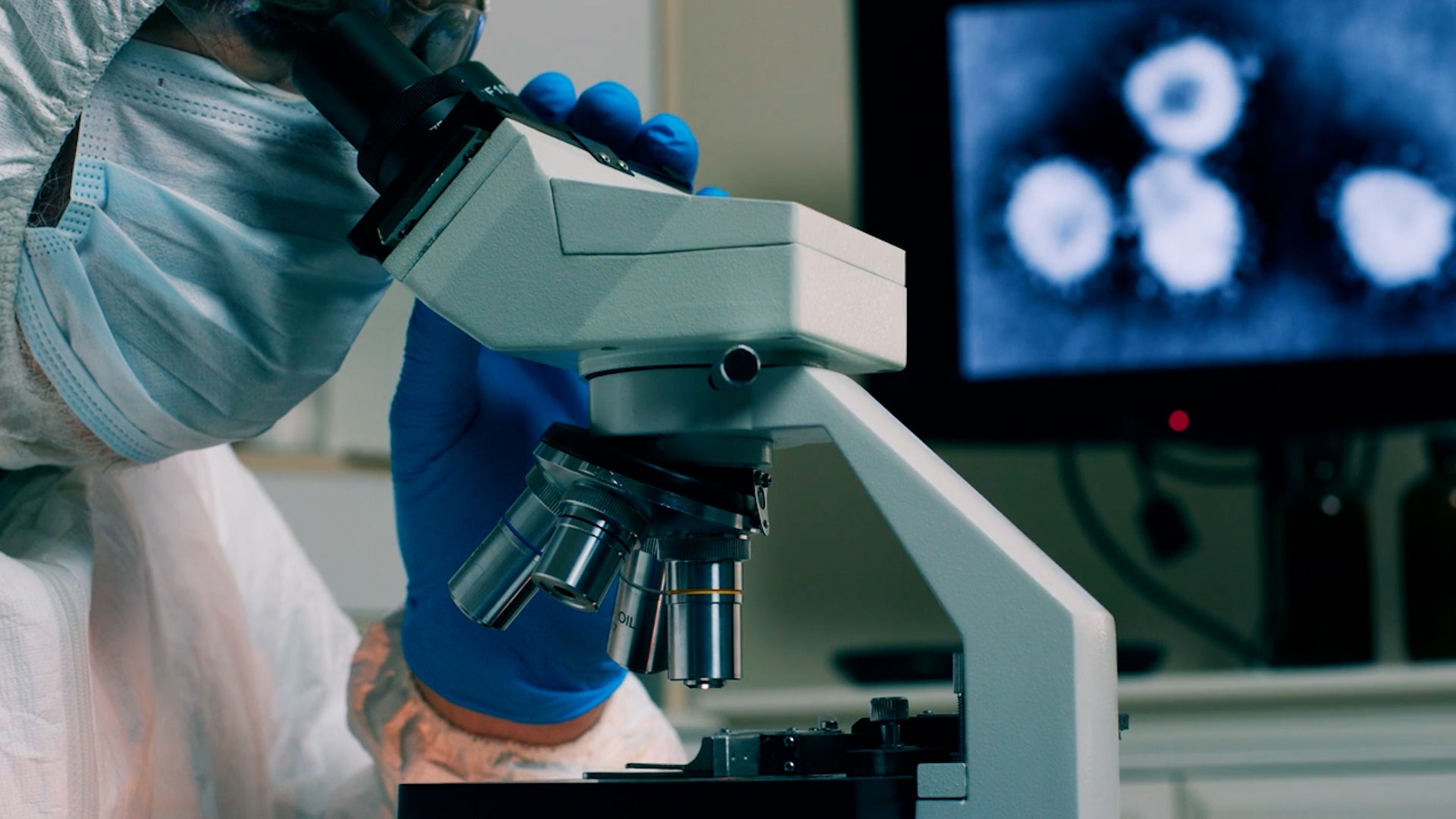 &lsquo;Concerning&rsquo; Mutation In US Patient With Severe Bird Flu