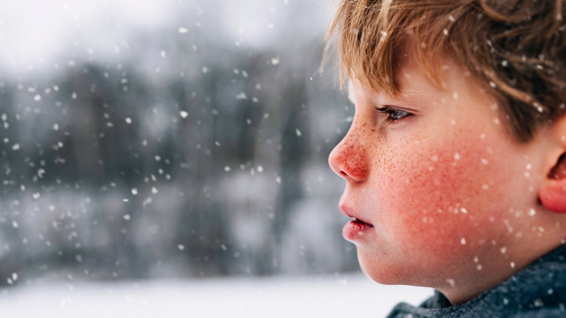 Why Do My Cheeks Get Red In The Cold? An Expert Explains