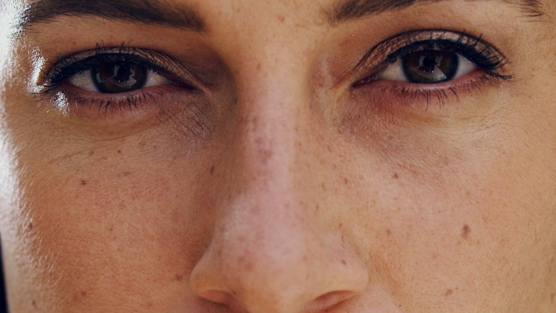 These Are The Worst States For Healthy Skin