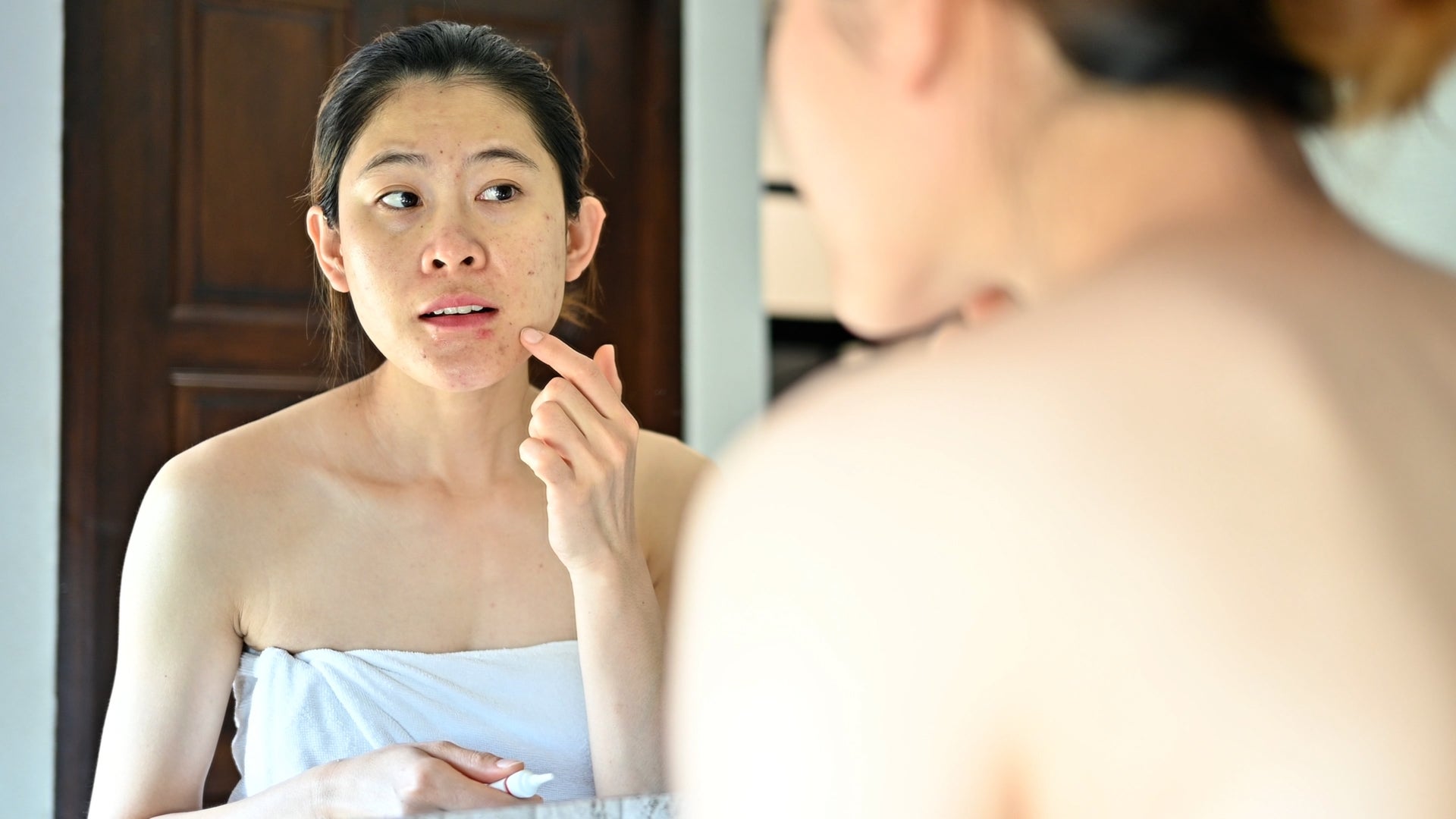 Carcinogens In Acne Treatments? FDA Reviewing Evidence