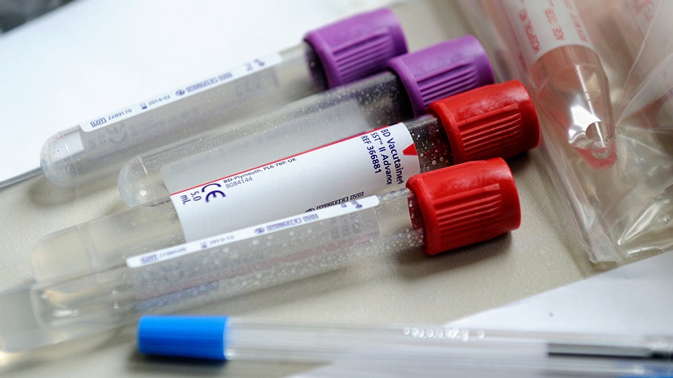 Diseases You Can Have - and Not Know It | The Weather Channel