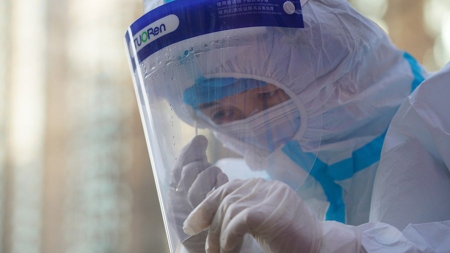 COVID19 Likely to Have LongTerm Negative Impact on Brain, Finds New