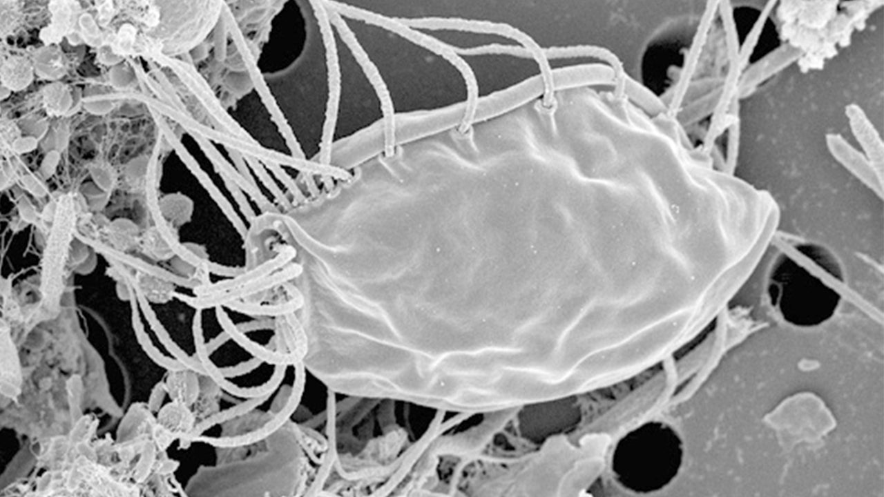 Descoberto organismo diferente de todas as formas de vida na Terra