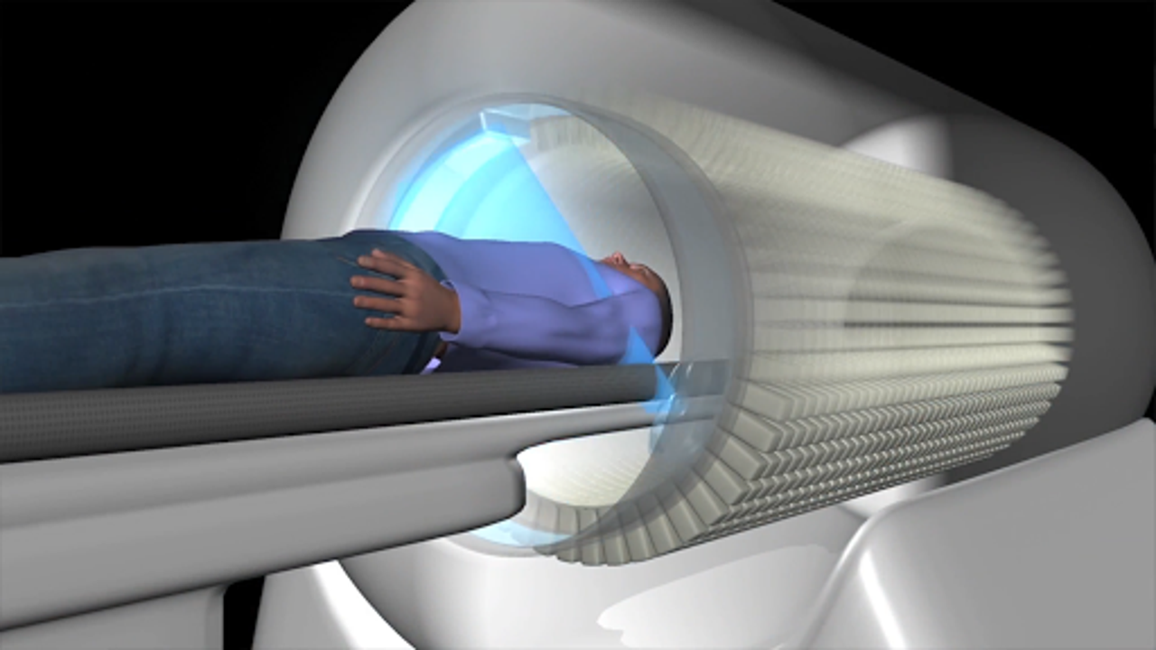 Who Invented Pet Scanner at Charles Mazurek blog