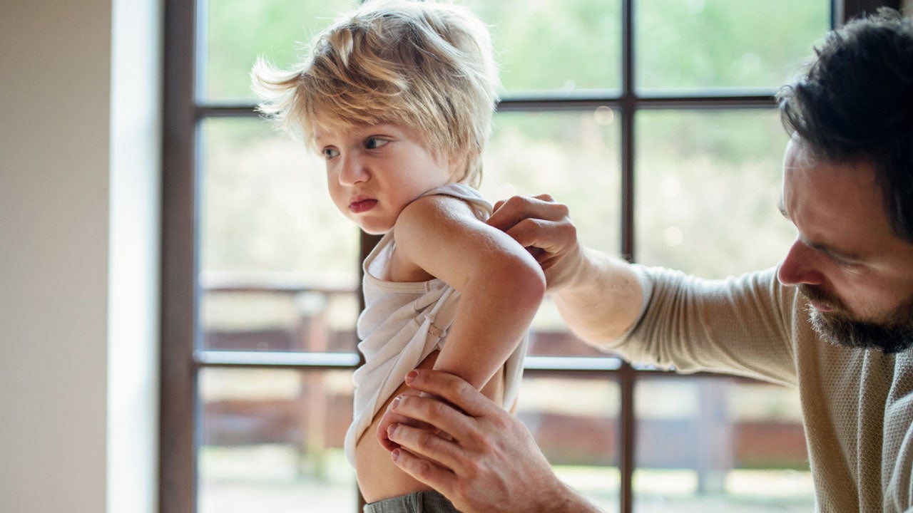 Father inspecting child's back for eczema