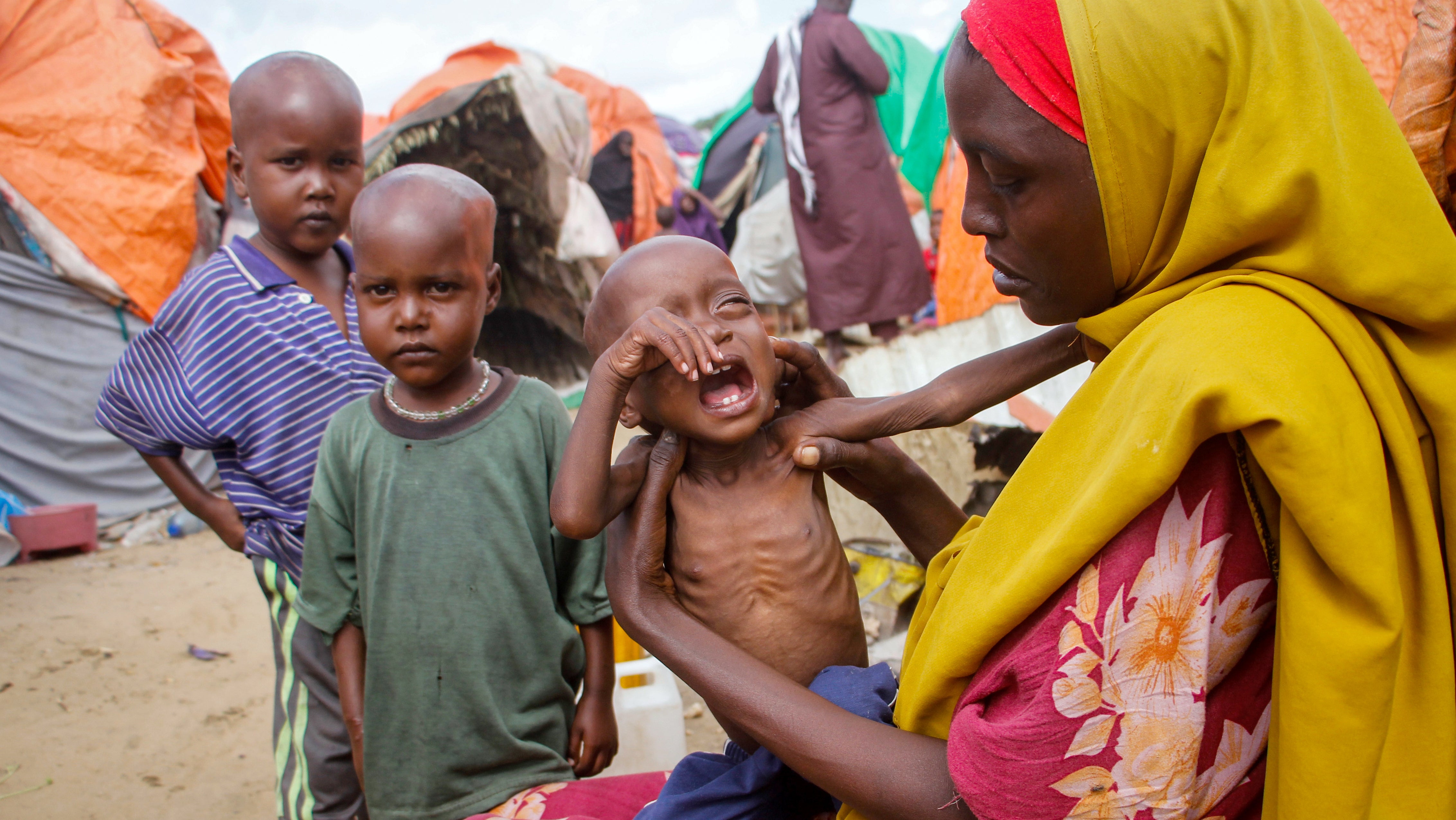 Somalia, Mogadischu: Maryan Madey, die aus der von D&uuml;rre heimgesuchten Region Lower Shabelle geflohen ist, h&auml;lt ihre unterern&auml;hrte Tochter Deka Ali (1) in einem Lager f&uuml;r Vertriebene am Stadtrand. Unsere andauernde Abh&auml;ngigkeit von Kohle, Gas und Erd&ouml;l beschleunigt nicht nur die Klimakrise: Sie versch&auml;rft auch die gesundheitlichen Folgen, die mit Erderw&auml;rmung, Luftverschmutzung und Extremwetterereignissen einhergehen.

