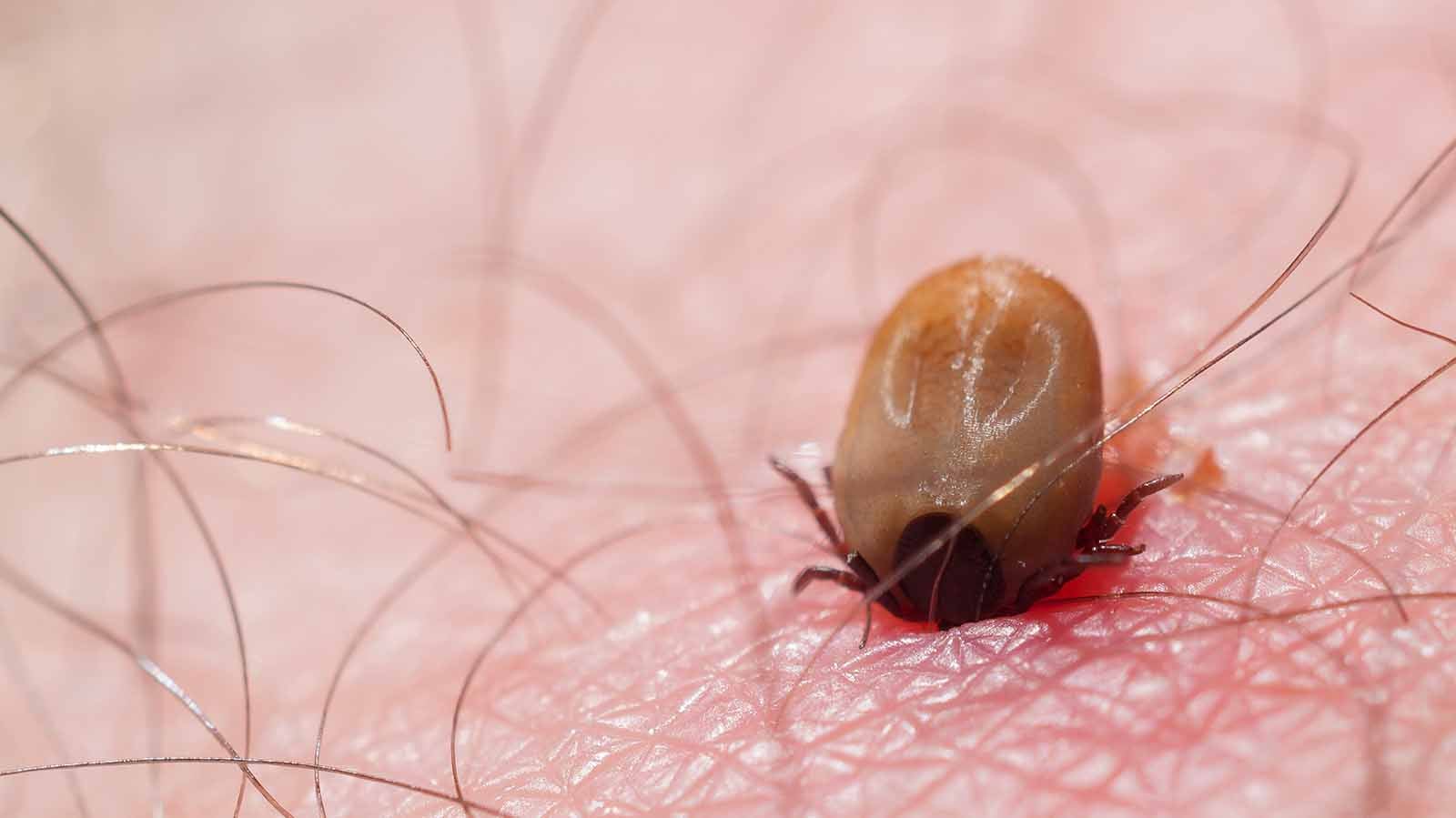 Tick on human skin