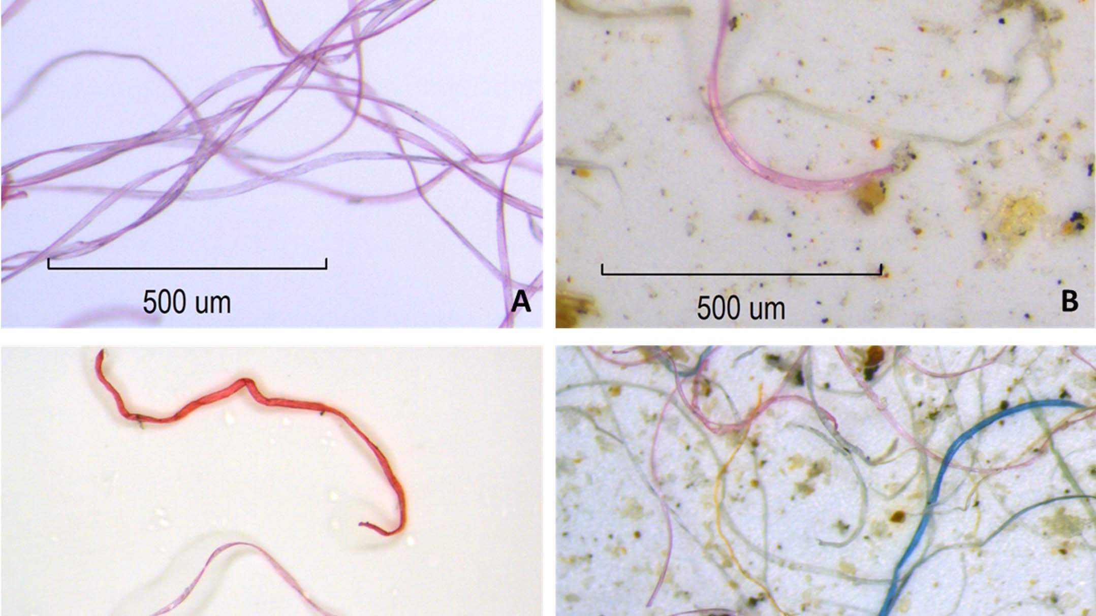 HANDOUT - 07.10.2020, ---, -: Das undatierte Handout-Bild zeigt vergr&circ;ﬂerte Mikrofasern. Elektrische W&permil;schetrockner geben mehrere Tausend Mikrofasern in die Umgebung ab - bei einem einzigen Durchlauf. (zu dpa &acute;W&permil;schetrockner setzten groﬂe Mengen an Mikrofasern frei&ordf;) Foto: Rachael Z. Miller/Plos One/dpa - ACHTUNG: Nur zur redaktionellen Verwendung im Zusammenhang mit der aktuellen Berichterstattung und nur mit vollst&permil;ndiger Nennung des vorstehenden Credits +++ dpa-Bildfunk +++