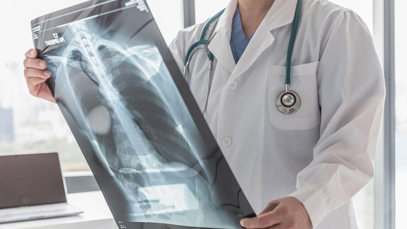 Doctor with radiological chest x-ray film for medical diagnosis on patient's health on asthma, lung disease and bone cancer illness