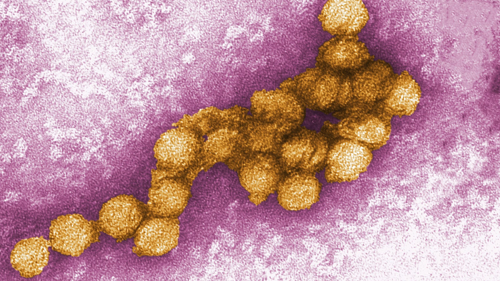 ARCHIV - 22.08.2012, USA, Atlanta: Das West-Nil-Virus unter dem Elektronenmikroskop. Erstmals ist in&nbsp;Deutschland eine durch M&uuml;cken &uuml;bertragene West-Nil-Infektion beim Menschen nachgewiesen geworden. Foto: Cynthia Goldsmith/CENTERS FOR DISEASE CONTROL/EPA/dpa - ACHTUNG: Nur zur redaktionellen Verwendung im Zusammenhang mit der aktuellen Berichterstattung und nur mit vollst&auml;ndiger Nennung des vorstehenden Credits +++ dpa-Bildfunk +++