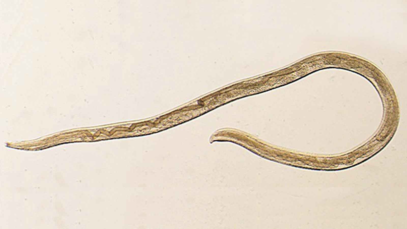 This undated photo provided by the Centers for Disease Control and Prevention (CDC) shows Thelazia gulosa, a type of eye worm seen in cattle in the northern United States and southern Canada, but never before in humans. An Oregon woman who had worms coming out of her eye is being called the first known human case of a parasitic infection spread by flies. Fourteen tiny worms were removed from the left eye of the 26-year-old woman in August 2016. Scientists reported the case Monday, Feb. 12, 2018. (CDC via AP)