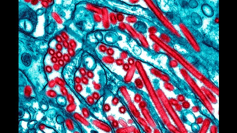 17 Things You Probably Didn T Know About The Flu The Weather Channel