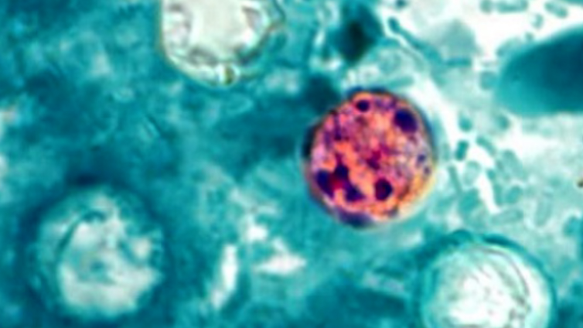 Is summer heat fueling an explosive diarrhea outbreak?