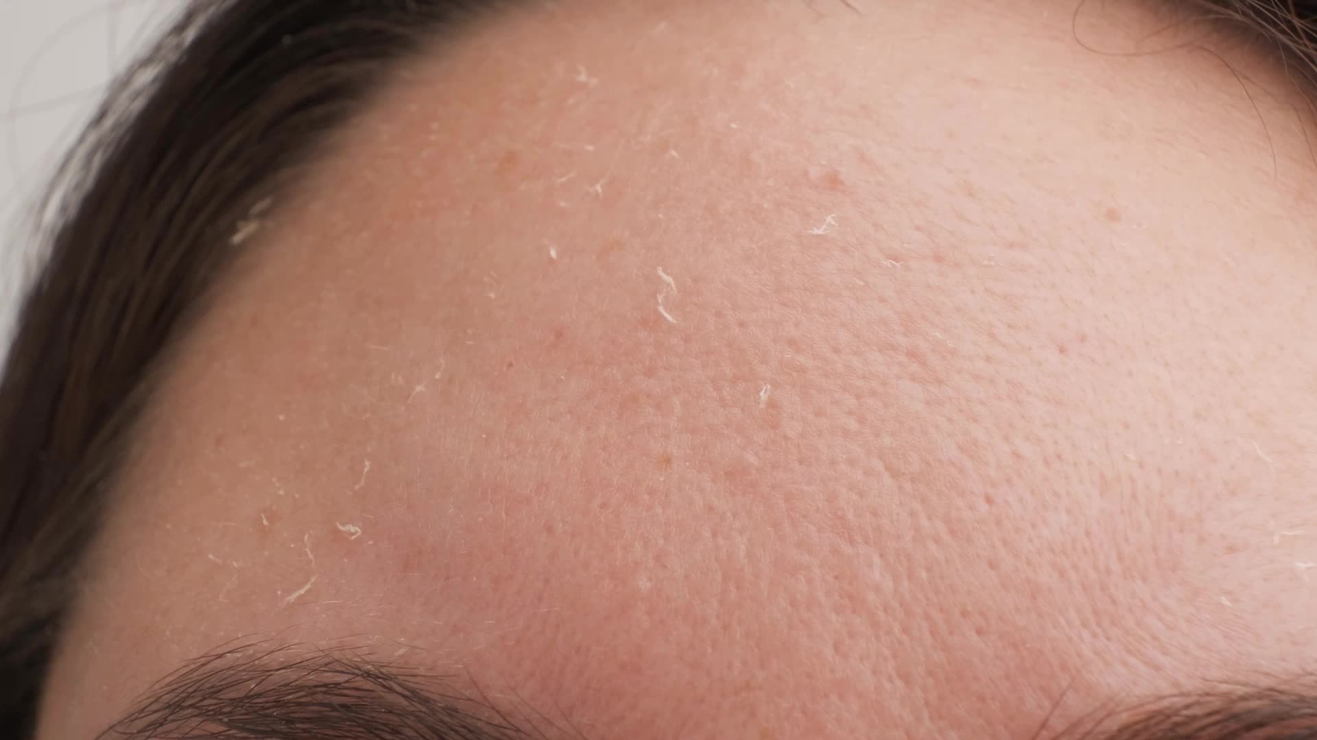 As We Enter Spring, Is Skin-Drying Weather Over?
