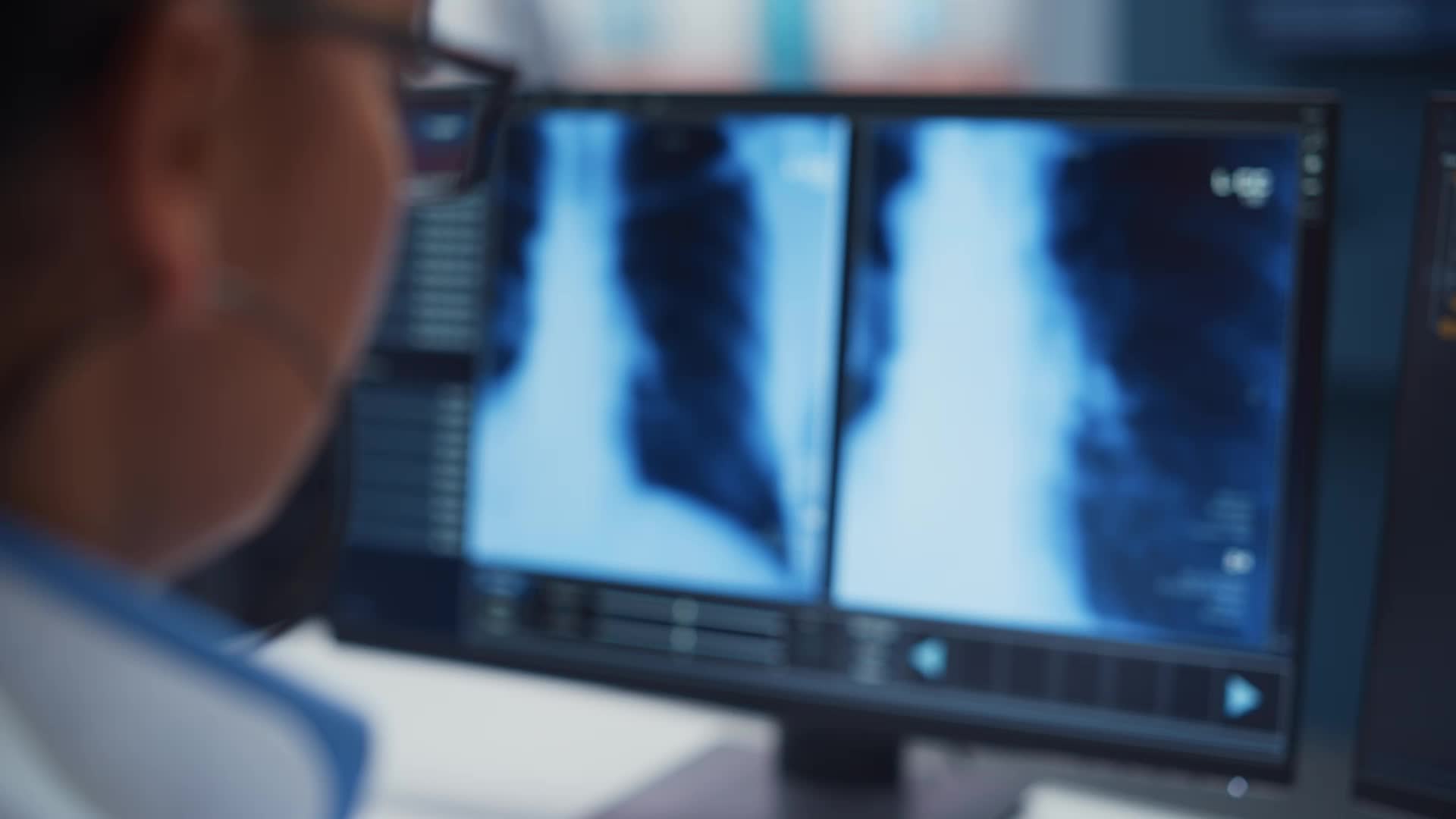 Experts Find Previously Unknown Cause Of Asthma Lung Damage