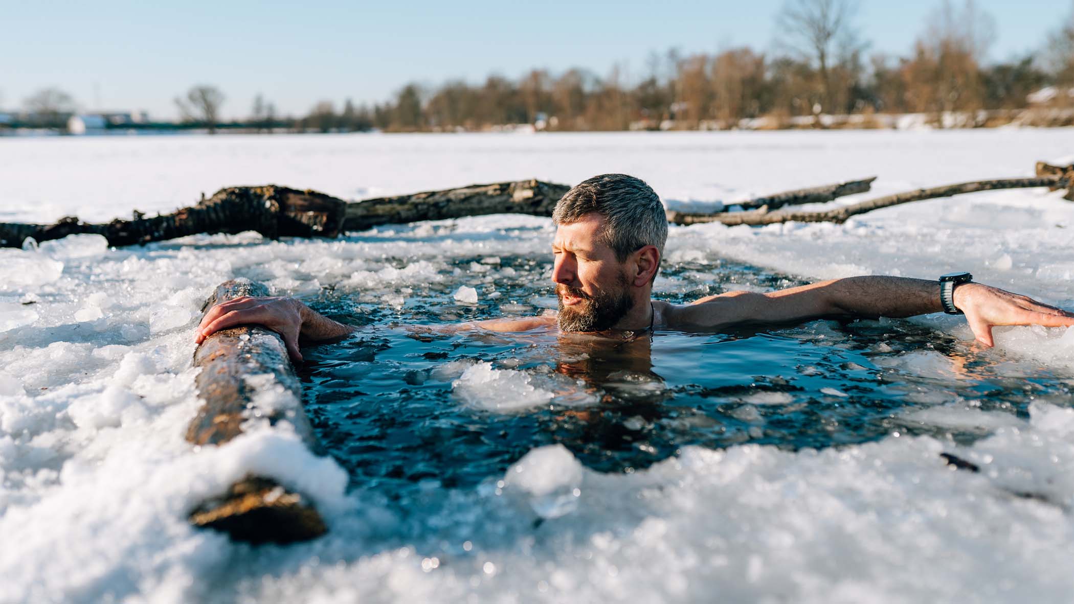 Ice baths can be dangerous for those with cold urticaria.