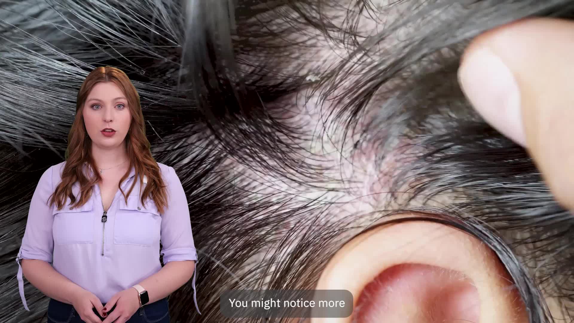 Managing Dry Scalp In Cold Weather