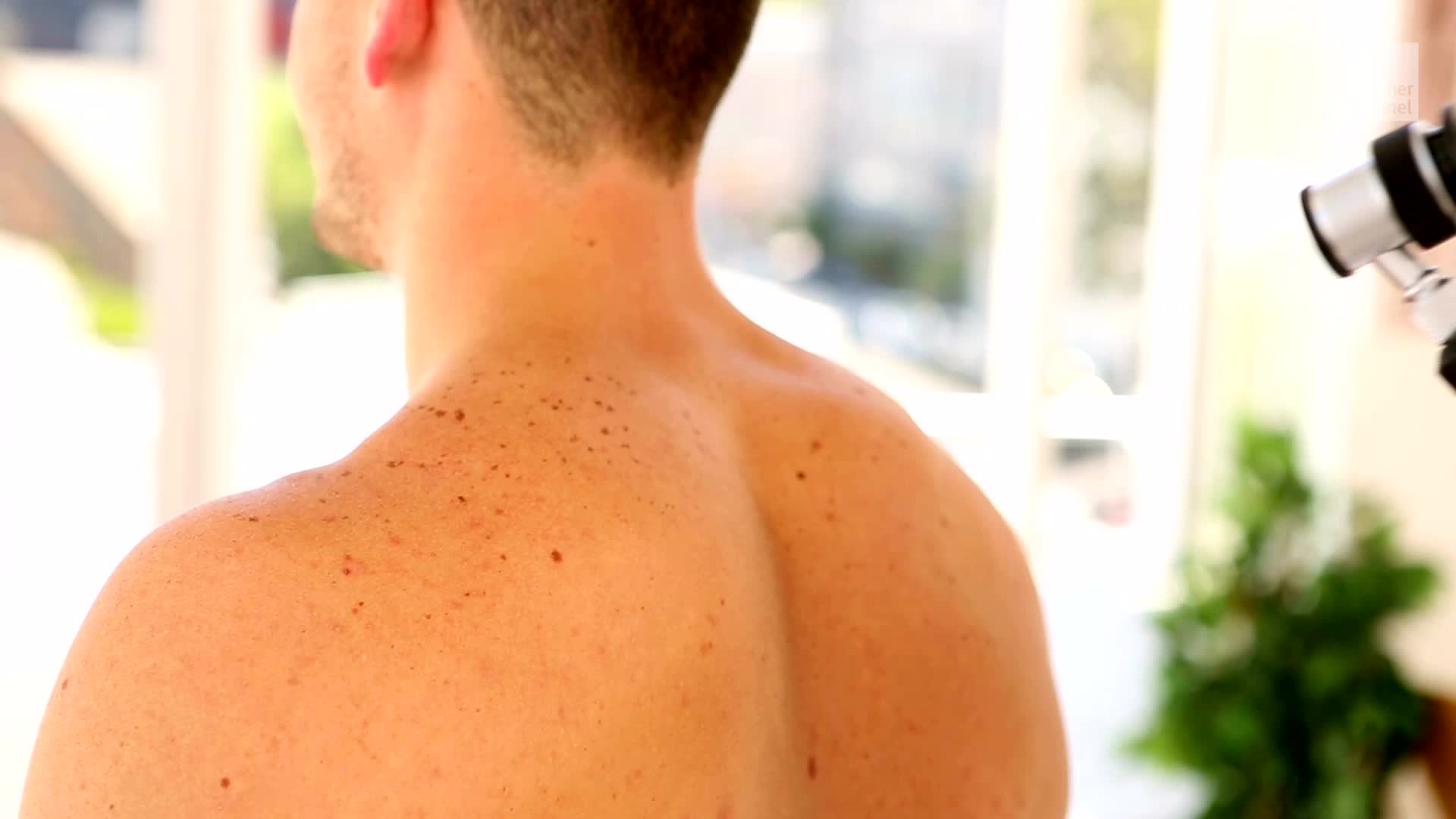 Skip The Scalpel For &lsquo;Virtual Biopsy&rsquo; Of Moles, Skin Tissue
