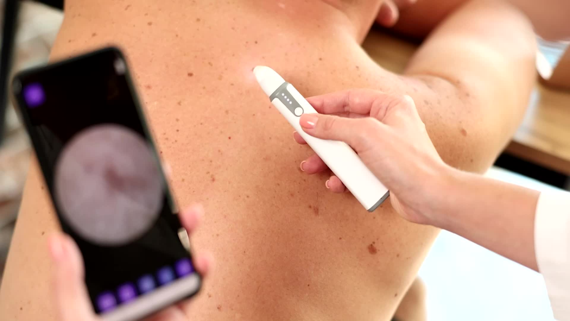 Study: Overdiagnosis Of Skin Cancer Up Over Time