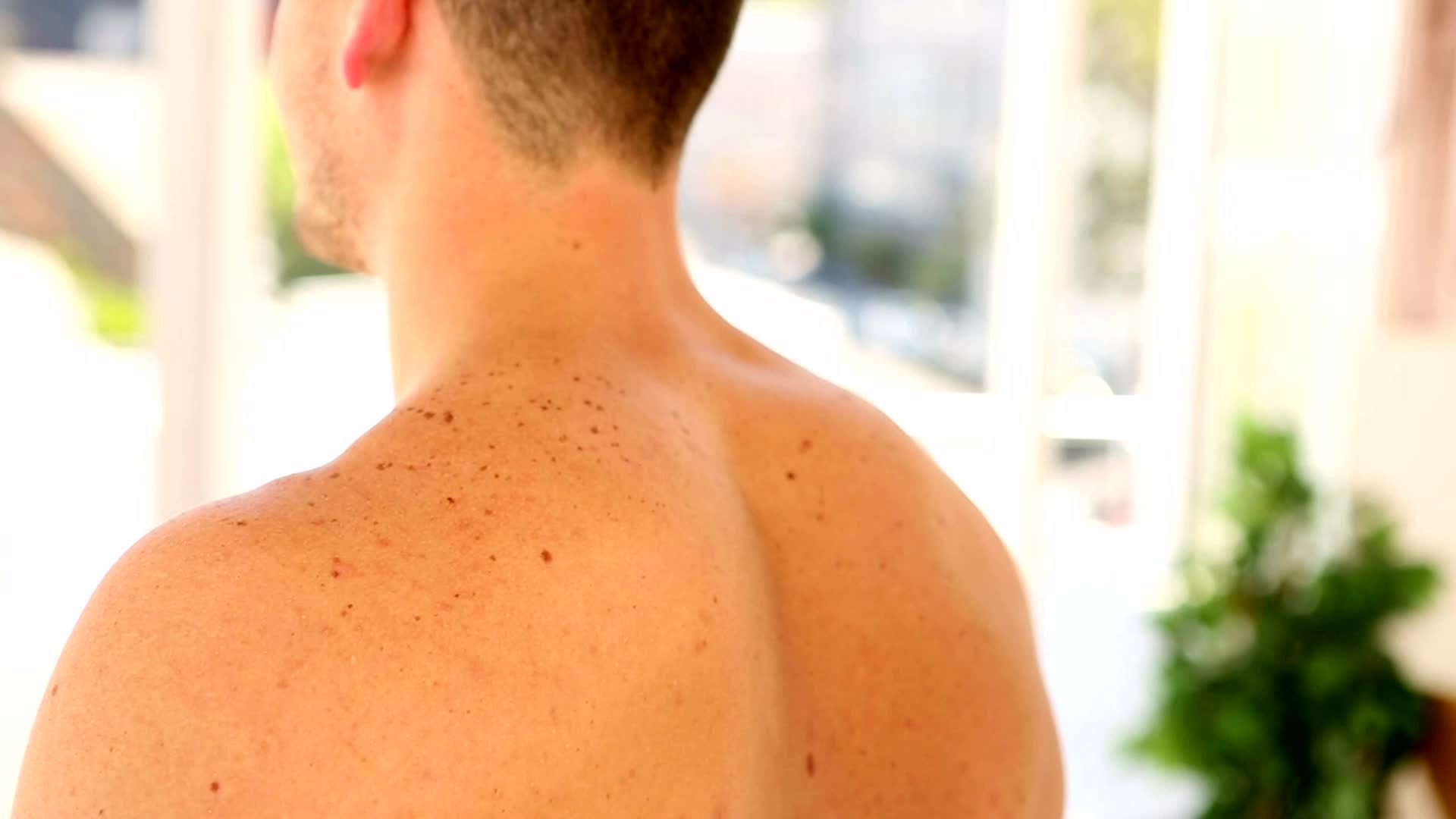 These 5 States Have Highest Rates Of Melanoma