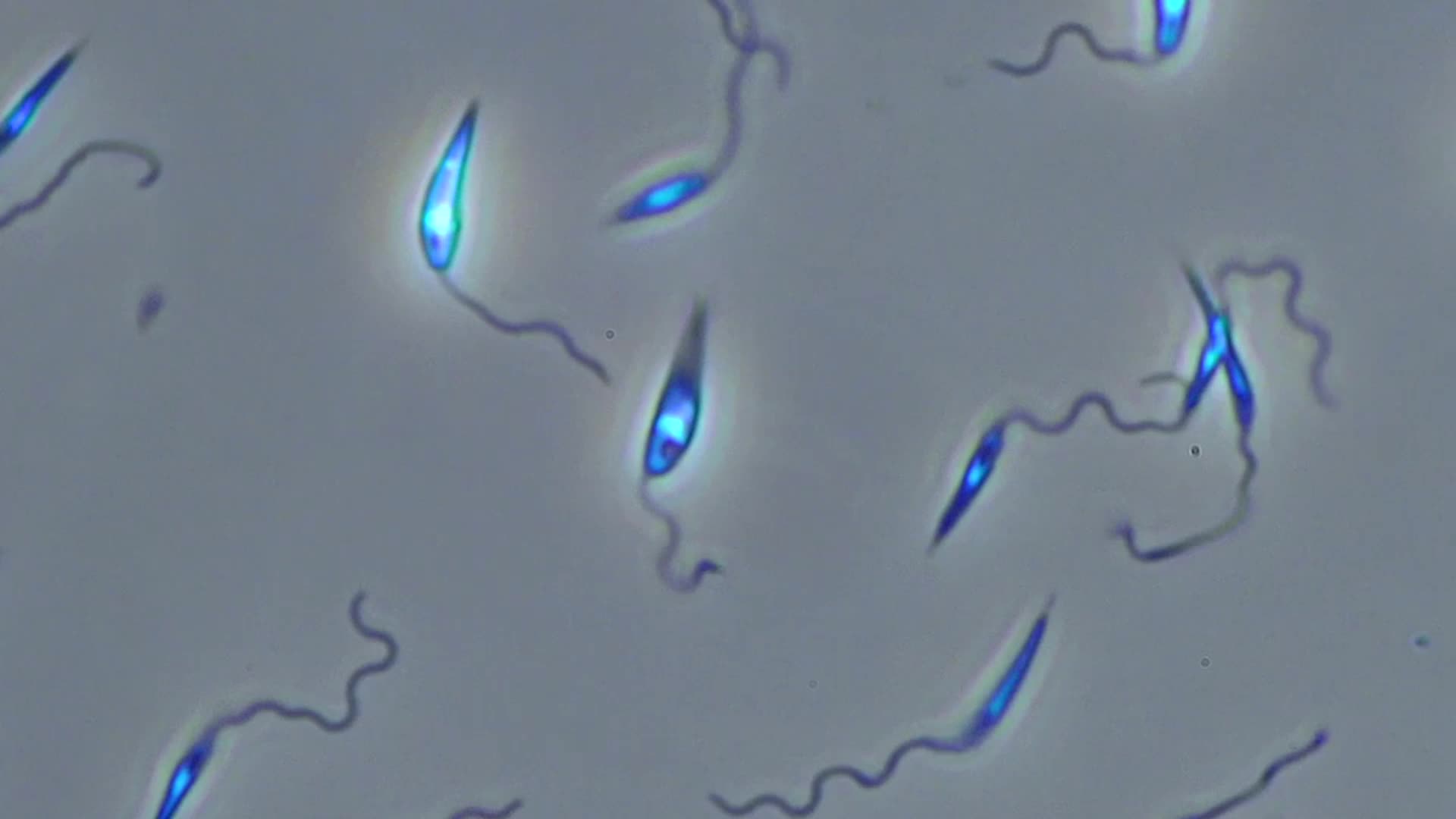 Tropical Disease Spread By Sandflies More Common In US