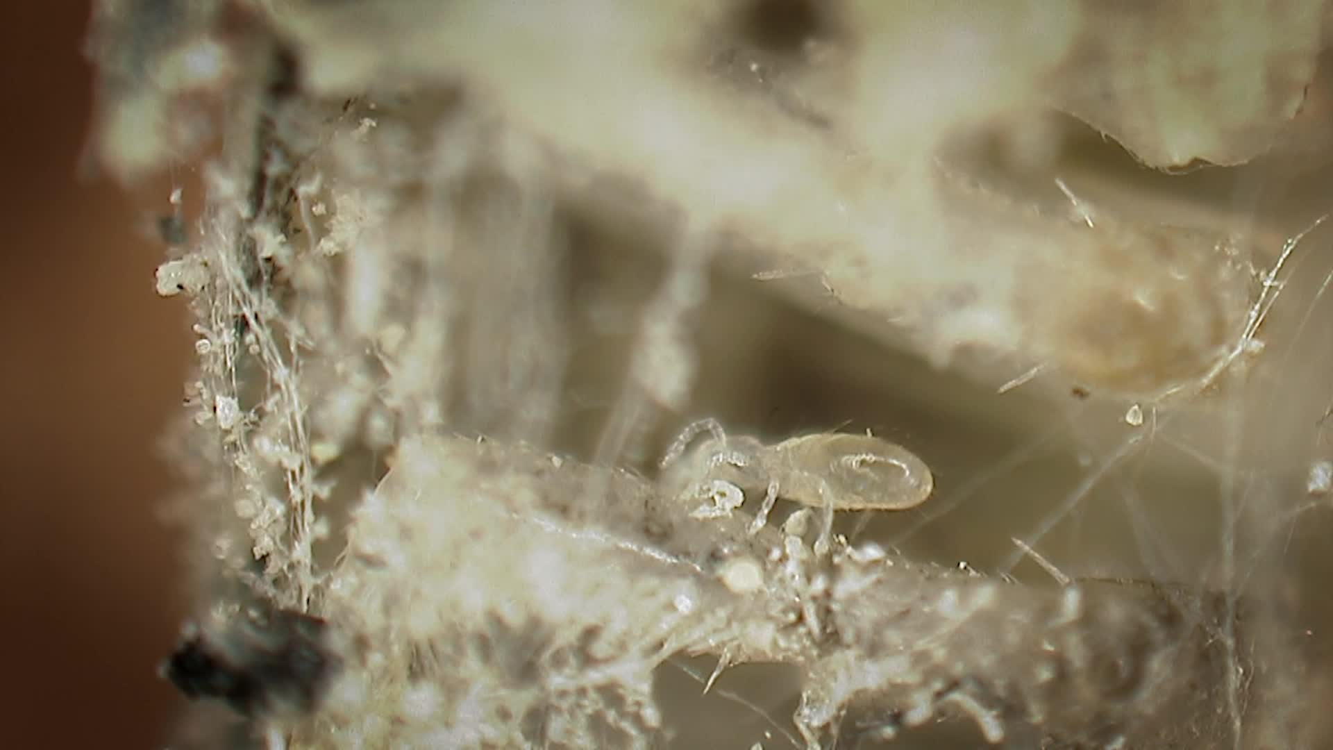 What&rsquo;s The Deal With Dust Mites?