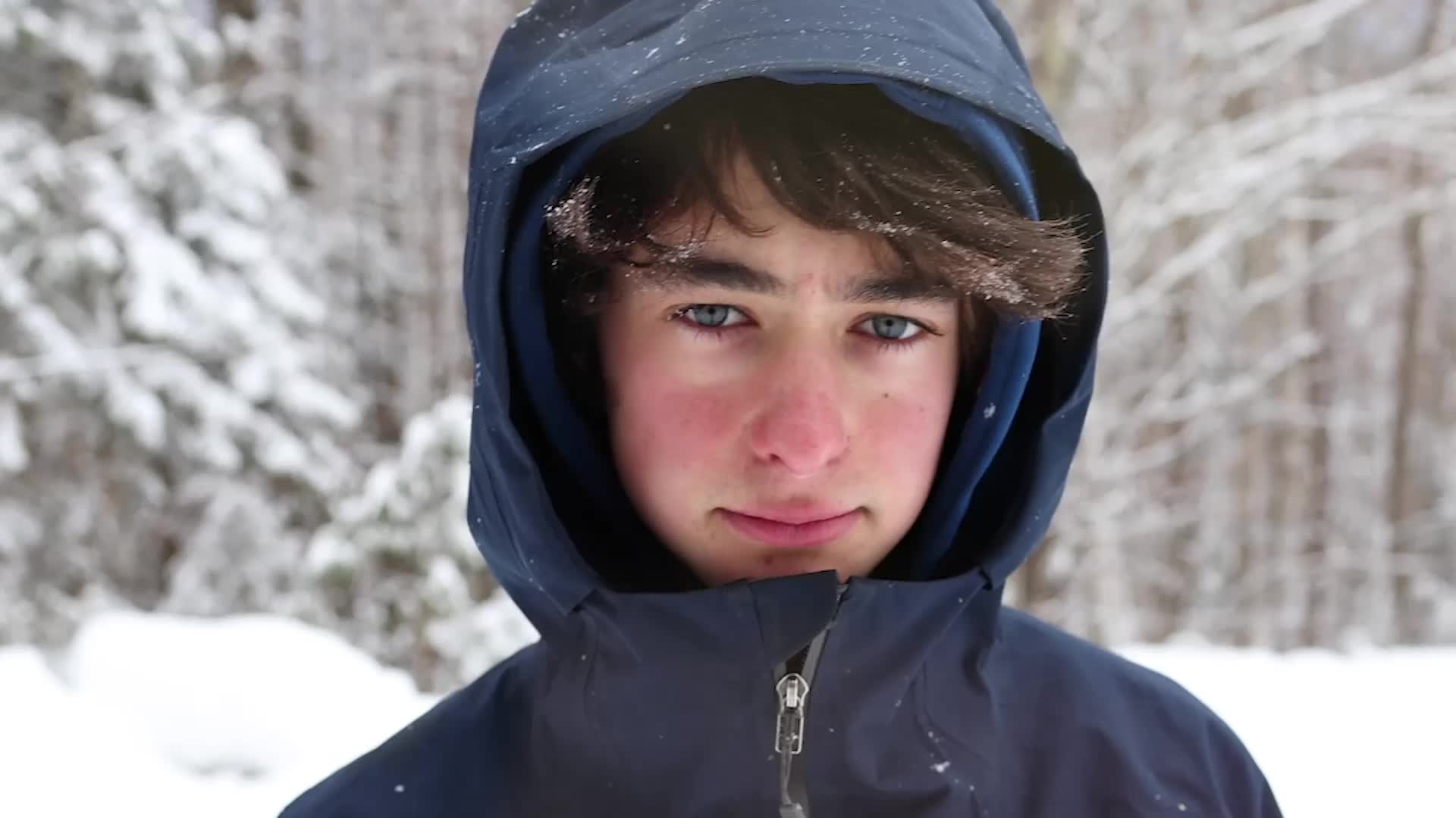 Why Do My Cheeks Get Red In The Cold? An Expert Explains